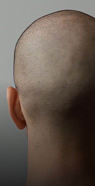 Tricopigmentation